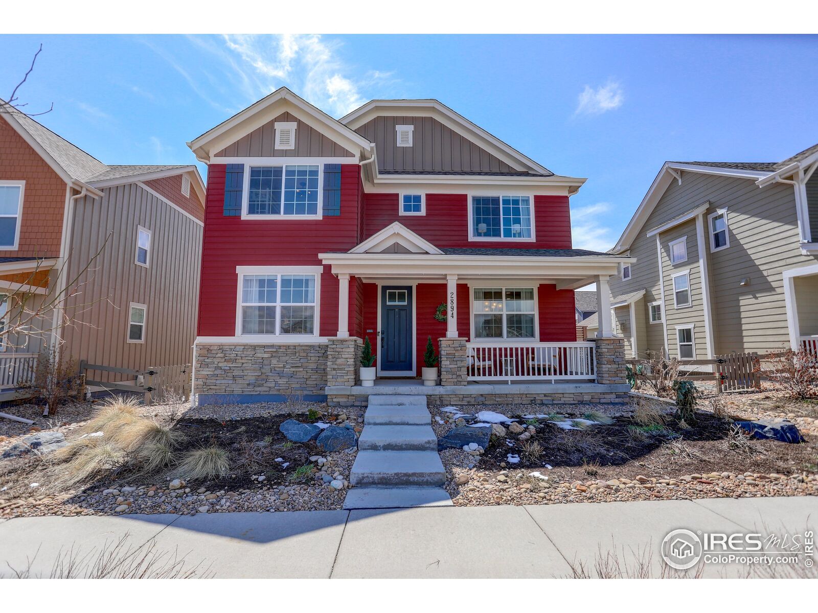 Property Photo: 2894 Twin Lakes Cir CO 80026