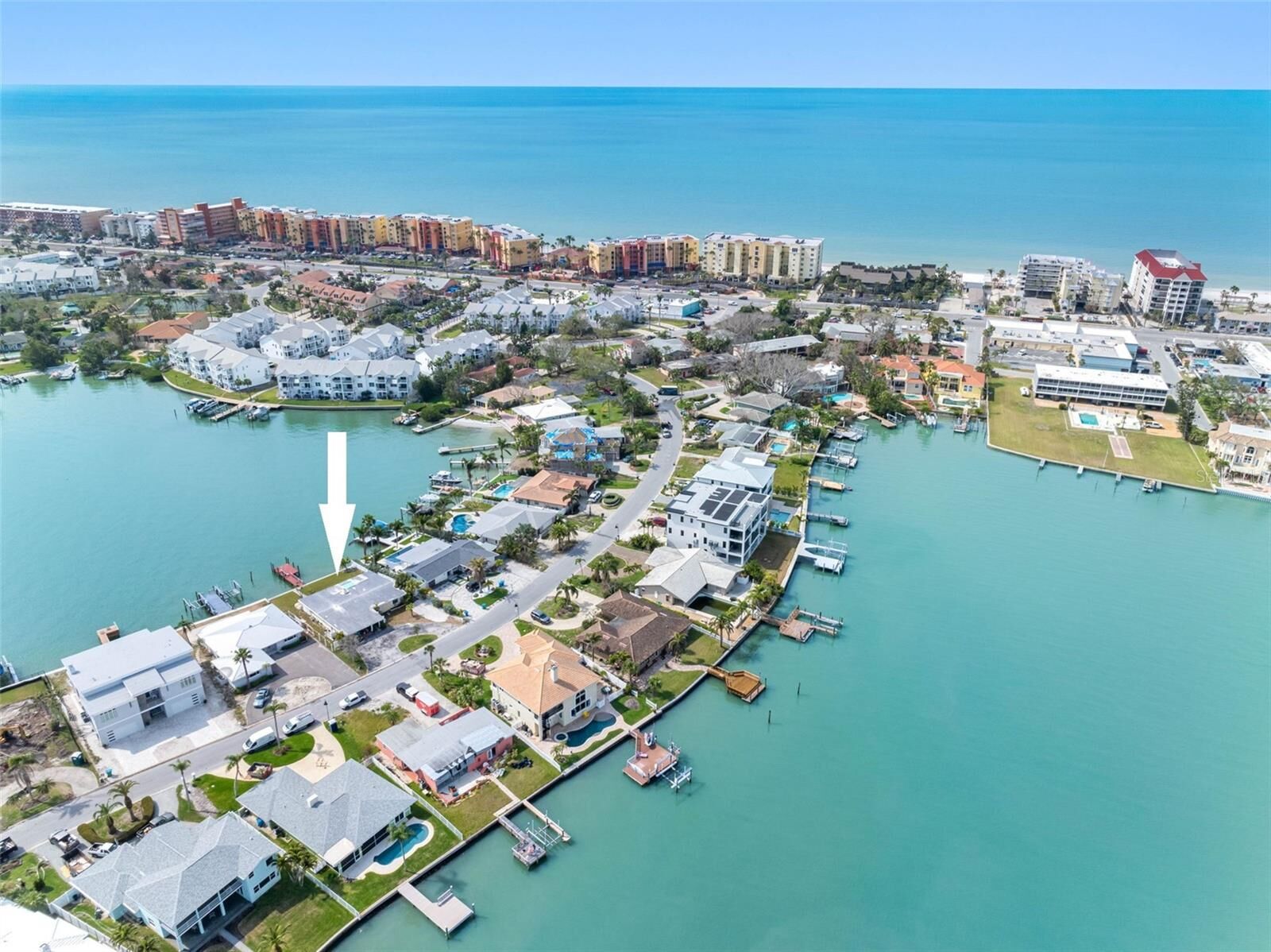 Property Photo: 203 Bath Club Boulevard N FL 33708